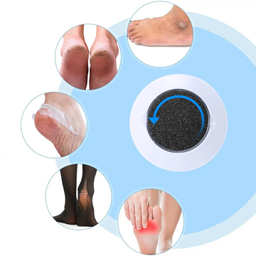 Callus and Crack Remover - Electric Foot File for Smooth Feet