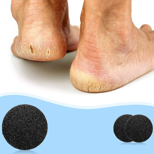 Callus and Crack Remover - Electric Foot File for Smooth Feet